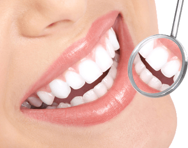Professional Teeth Whitening Services in Millersville, MD