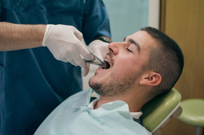 Tooth Extraction Procedures in Millersville, MD